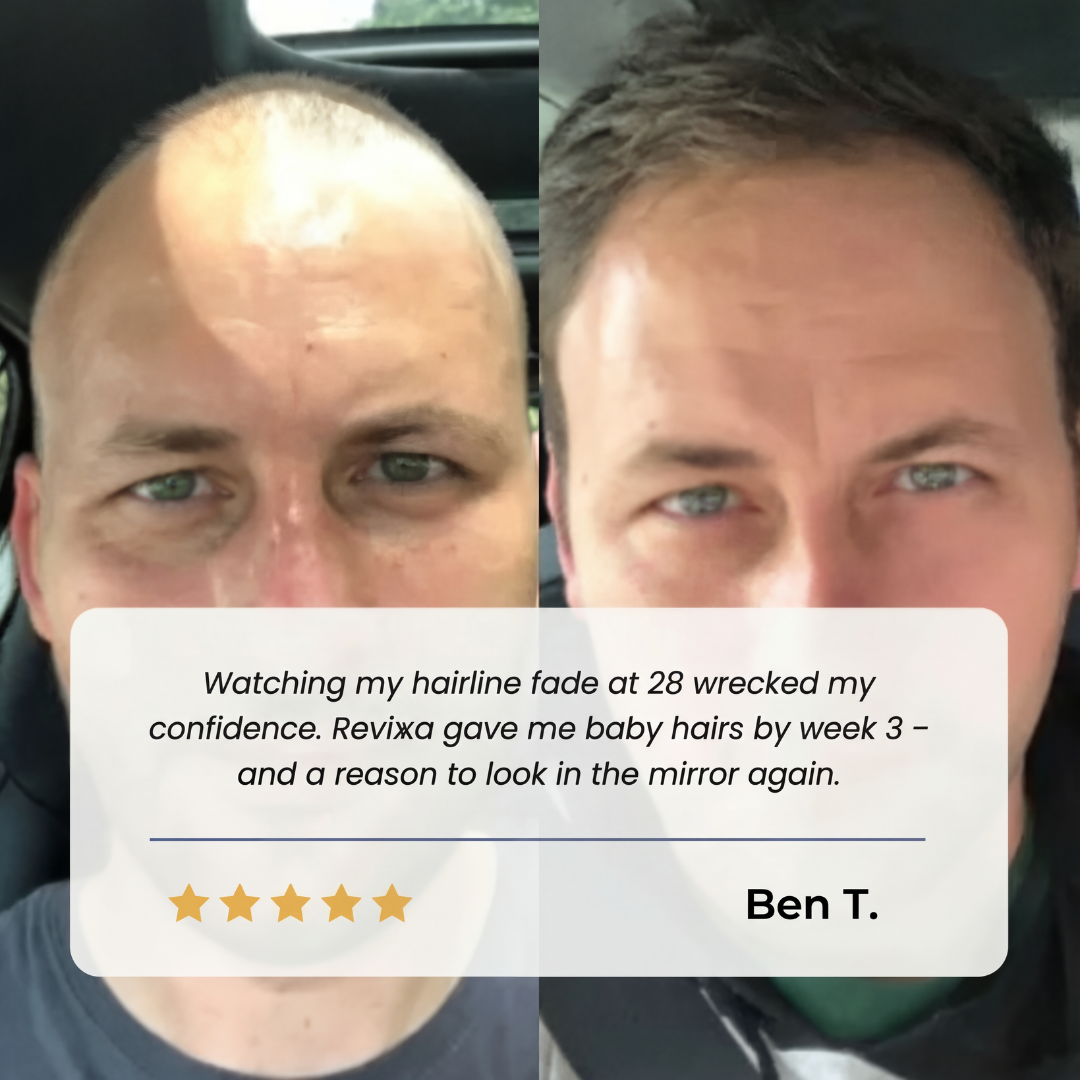 Revixa® Follicle Renewal Serum [Restore Hair Growth]